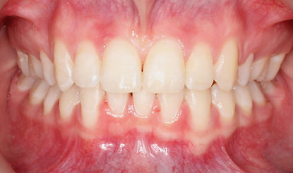 Case 4 after treatment