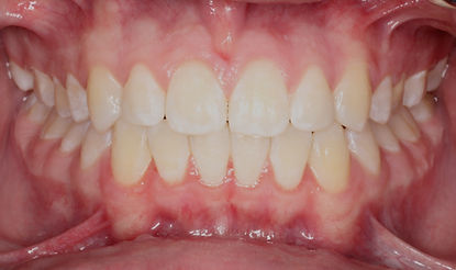 Case 6 after treatment