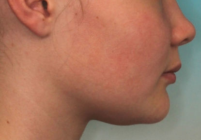 Case 8 after treatment
