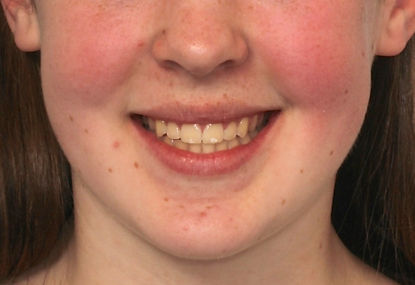 Case 10 after treatment
