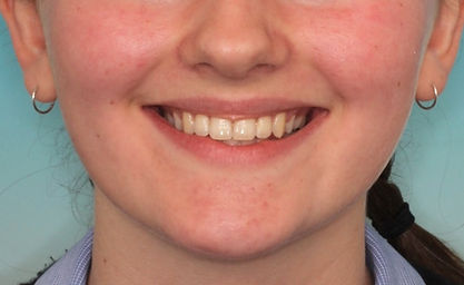 Case 3 after treatment