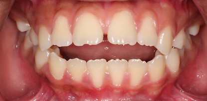 Case 12 before treatment
