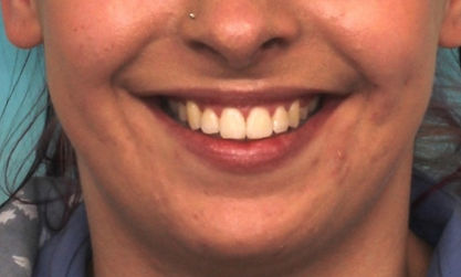 Case 7 after treatment