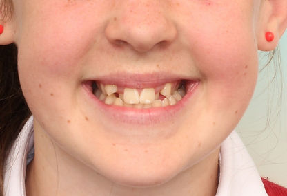 Case 10 before treatment