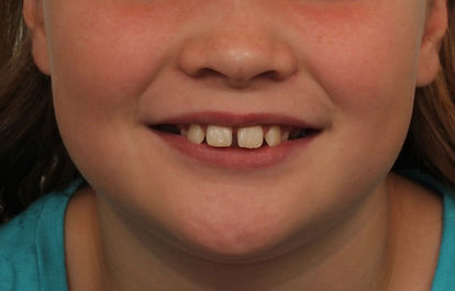Case 9 before treatment