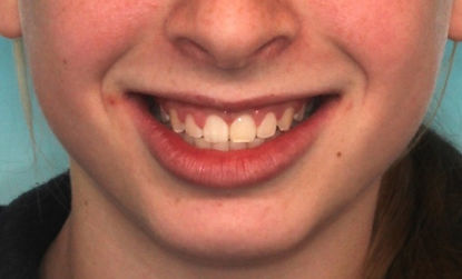 Case 1 after treatment