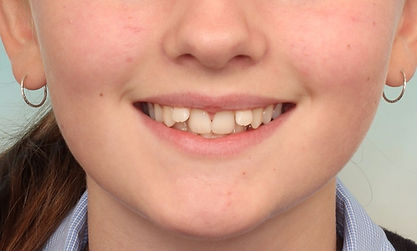 Case 3 before treatment