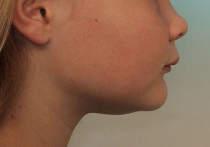 Case 8 before treatment
