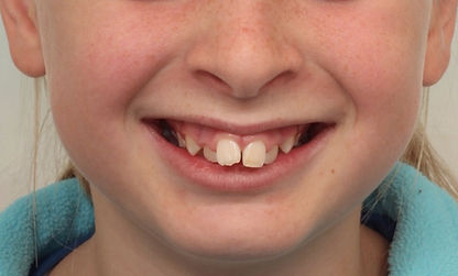 Case 1 before treatment