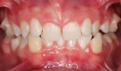 Case 6 before treatment