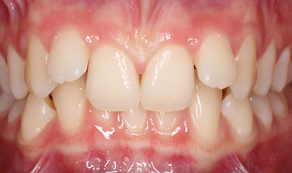 Case 4 before treatment