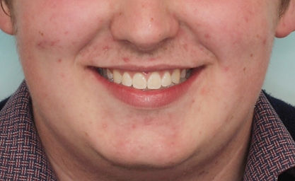 Case 5 after treatment