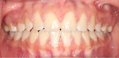 Case 12 after treatment
