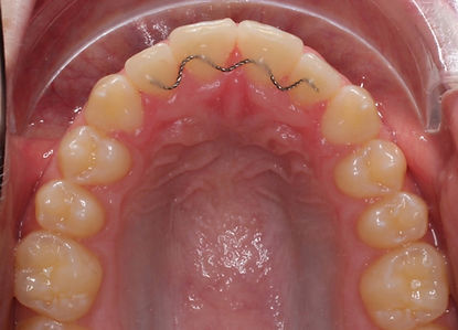 Case 11 after treatment