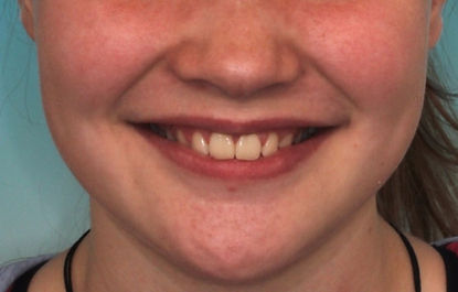 Case 9 after treatment