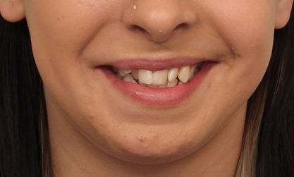 Case 7 before treatment