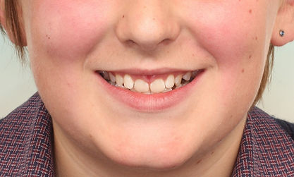 Case 5 before treatment