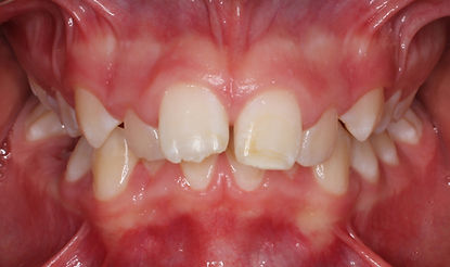 Case 2 before treatment