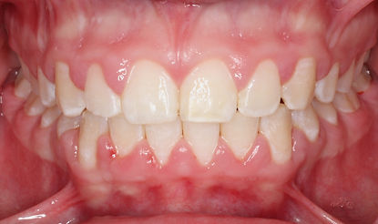 Case 2 after treatment