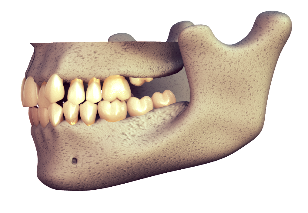 Surgical Orthodontics